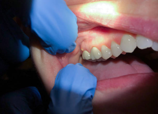 Best Urgent Dental Care for Toothaches in Fairfield Harbour, NC