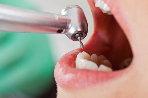 Professional Emergency Dental Service in NC